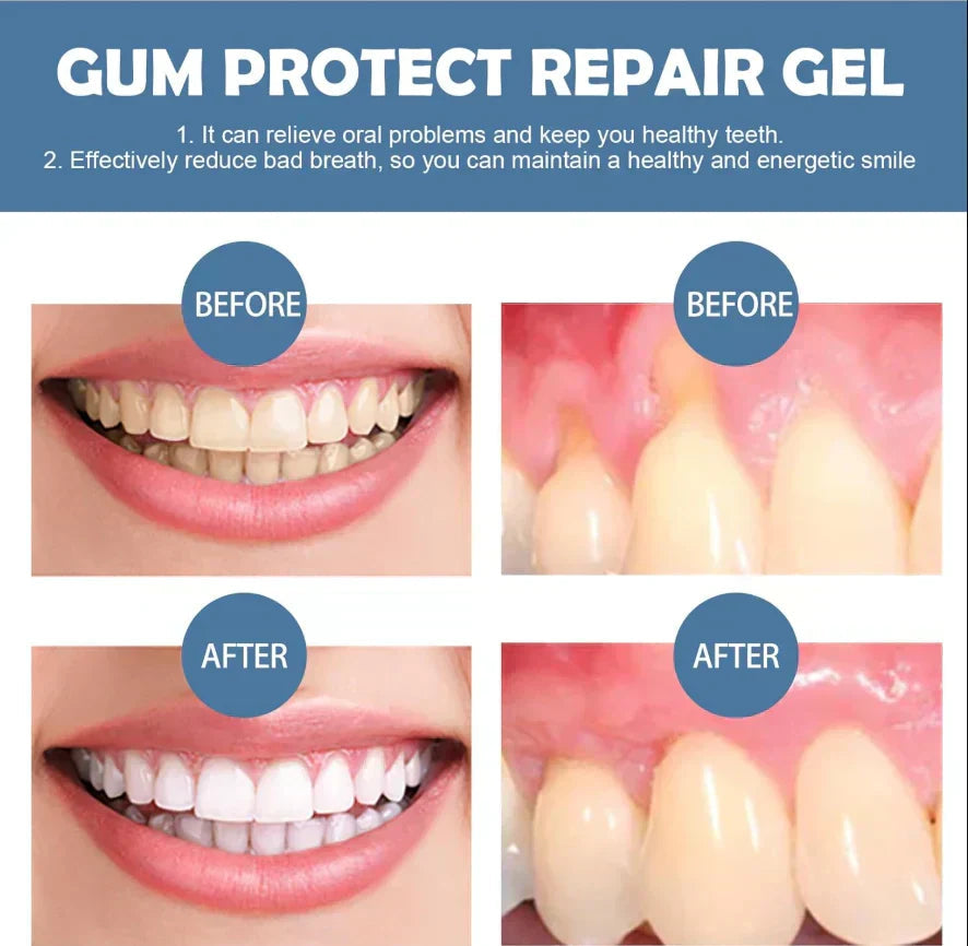 📢📢50% Off!!⏰ Guocalm ® Gum Protect Repair Gel Gingival Repair & Protection Oral Care Gel 🦷