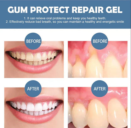 📢📢50% Off!!⏰ Guocalm ® Gum Protect Repair Gel Gingival Repair & Protection Oral Care Gel 🦷