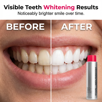 😁 ✨Stain‑Removing Whitening Mouthwash – Lifts coffee & tea stains, alcohol‑free. Instant gunk binding, long‑lasting minty fresh. Gentle enough for daily use. 🦷